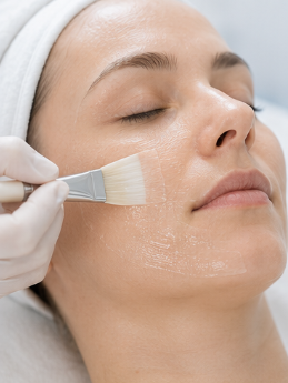 Chemical peel treatment